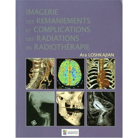 IMAGERIE DES RAMANIEMENTS ET COMPLICATIONS DES RADIATIONS EN RADIOTHERAPIE