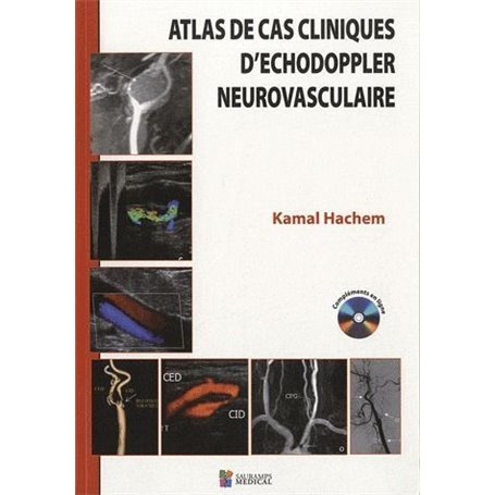 ATLAS DES CAS CLINIQUES D'ECHODOPPLER NEUROVASCULAIRE