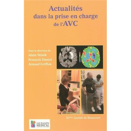 ACTUALITES DANS LA PRISE EN CHARGE DE L'AVC XVE JOURNEES DE MENUCOURT