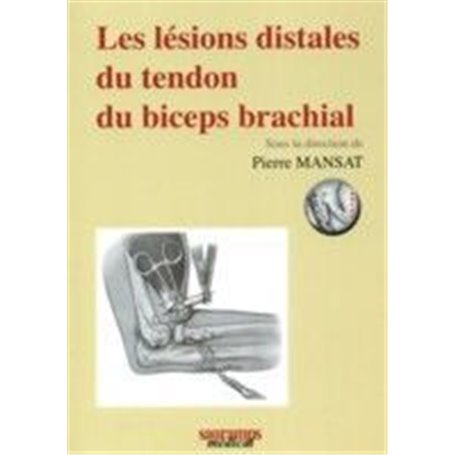 LES LESIONS DISTALES DU TENDRON DU BICEPS BRACHIAL