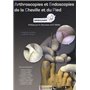 ARTHROSCOPIES ET ENDOSCOPIES DE LA CHEVILLE ET DU PIED