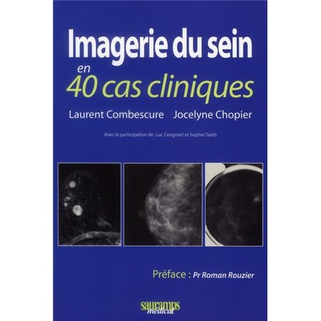 IMAGERIE DU SEIN EN 40 CAS CLINIQUES