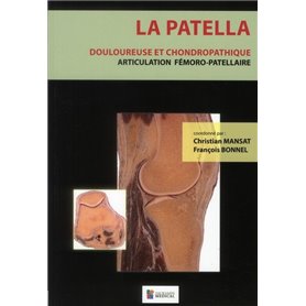 LA PATELLA