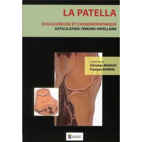 LA PATELLA