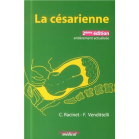 LA CESARIENNE. 2EME ED ACTUALISEE