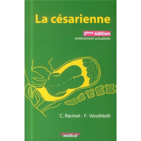 LA CESARIENNE. 2EME ED ACTUALISEE