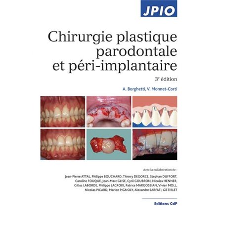 Chirurgie plastique parodontale et péri-implantaire