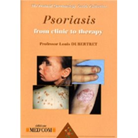 PSORIASIS VERSION ANGLAISE