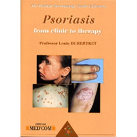 PSORIASIS VERSION ANGLAISE