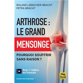 Arthrose : le grand mensonge