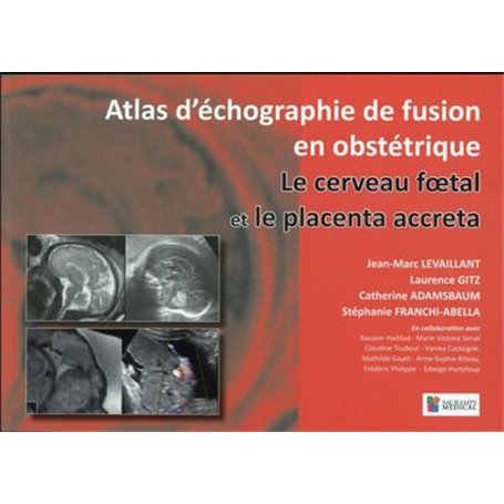 LE CERVEAU FOETAL ET LE PLACENTA ACCRETA. ATLAS D ECHOGRAPHIE DE FUSION EN GYNEC