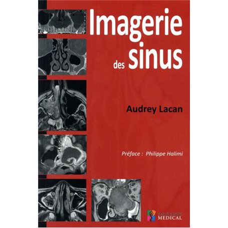 IMAGERIE DES SINUS