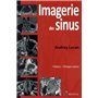 IMAGERIE DES SINUS