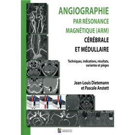 ANGIOGRAPHIE PAR RESONANCE MAGNETIQUE (ARM) CEREBRALE ET MEDULLAIRE