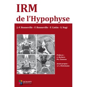 IRM DE L HYPOPHYSE