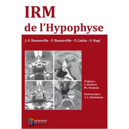 IRM DE L HYPOPHYSE