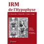 IRM DE L HYPOPHYSE