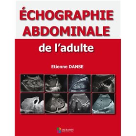 ECHOGRAPHIE ABDOMINALE DE L ADULTE