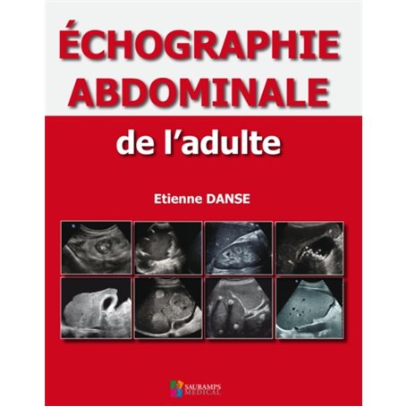 ECHOGRAPHIE ABDOMINALE DE L ADULTE