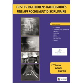 GESTES RACHIDIENS RADIOGUIDES-UNE APPROCHE