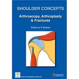 SHOULDER CONCEPTS ARTHROSCOPY ARTHROSPLASTY & FRACTURES