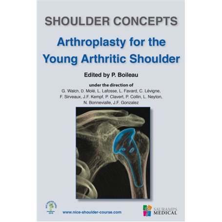 SHOULDER CONCEPTS ARTHROPLASTY FOR THE YOUNG ARTHRITIC SHOULDER