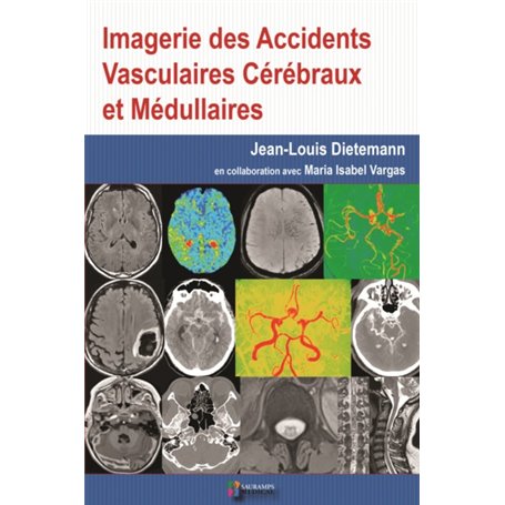 IMAGERIE DES ACCIDENTS VASCULAIRES CEREBRAUX ET MEDULLAIRES