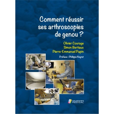 COMMENT REUSSIR SES ARTHROSCOPIES DE GENOU ?