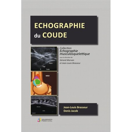 ECHOGRAPHIE DU COUDE