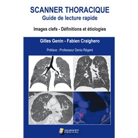 SCANNER THORACIQUE. GUIDE DE LECTURE RAPIDE