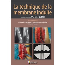 LA TECHNIQUE DE LA MEMBRANE INDUITE