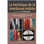 LA TECHNIQUE DE LA MEMBRANE INDUITE