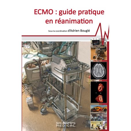 ECMO - GUIDE PRATIQUE DE REANIMATION