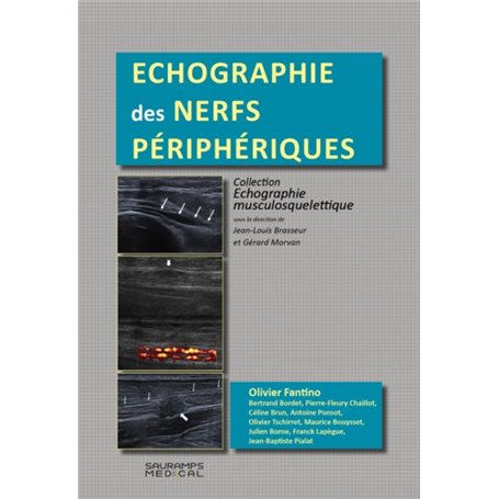 ECHOGRAPHIE DES NERFS PERIPHERQUES