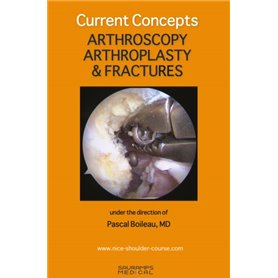 CURRENT CONCEPTS. ARTHROSCOPY, ARTHROPLASTY & FRACTURES