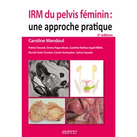 IRM du pelvis féminin 2e ED