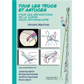 TOUS LES TRUCS ET ASTUCES POUR LES REPARATIONS DE LA COIFFE SOUS ARTHROSCOPIE