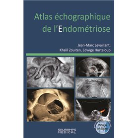 Atlas échographique de l'endométriose