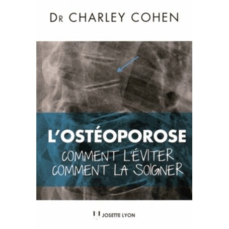 L'osteoporose - Comment l'éviter