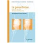 La gonarthrose