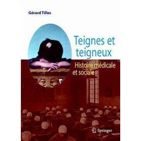 Teignes et teigneux