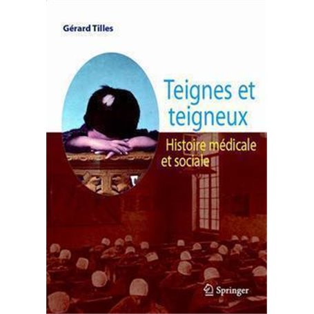 Teignes et teigneux