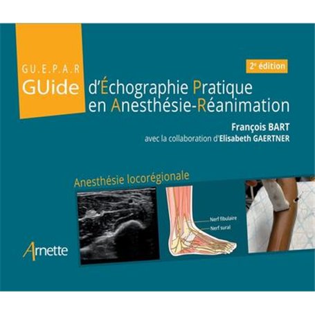 Guide d'échographie pratique en anesthésie-réanimation