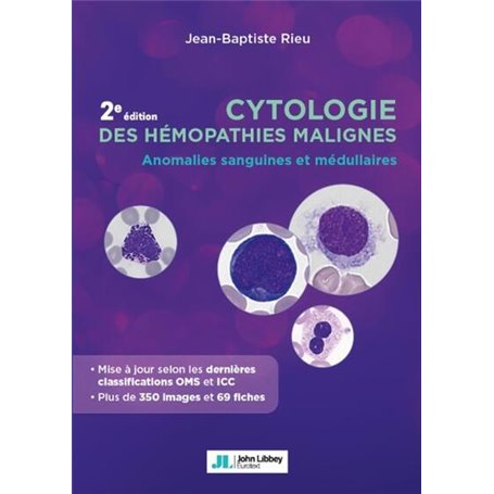 Cytologie des hémopathies malignes