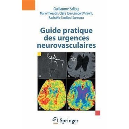 Guide pratique des urgences neurovasculaires