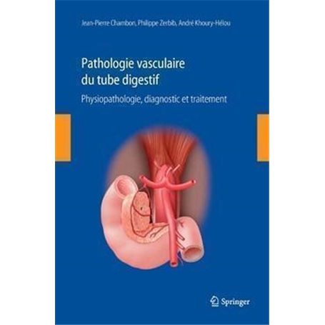 Pathologie vasculaire digestive