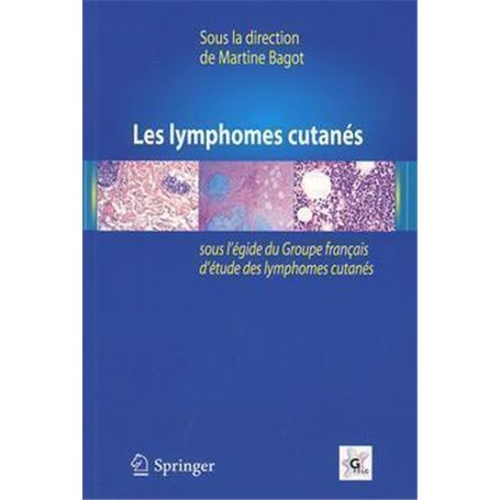 Les lymphomes cutanés