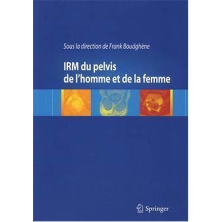 IRM du pelvis de l'homme et de la femme