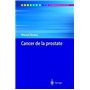 Cancer de la prostate