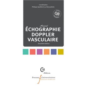 échographie doppler vasculaire